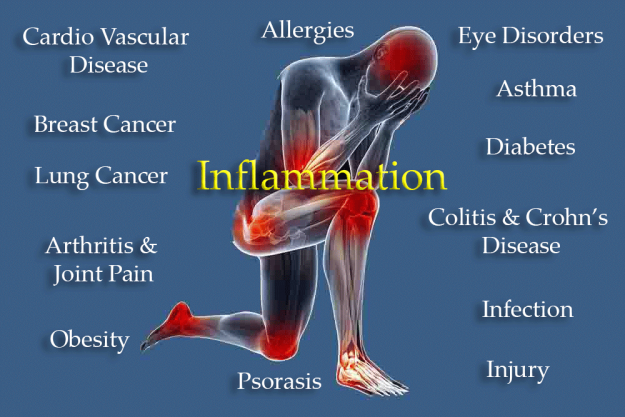 Picture of Inflammation